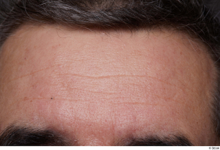 HD Face Skin Santino Freixa face forehead hair skin pores…